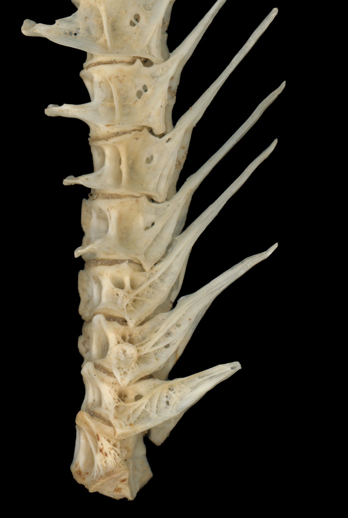 Mia Farrugia - Physis - Vertebrae