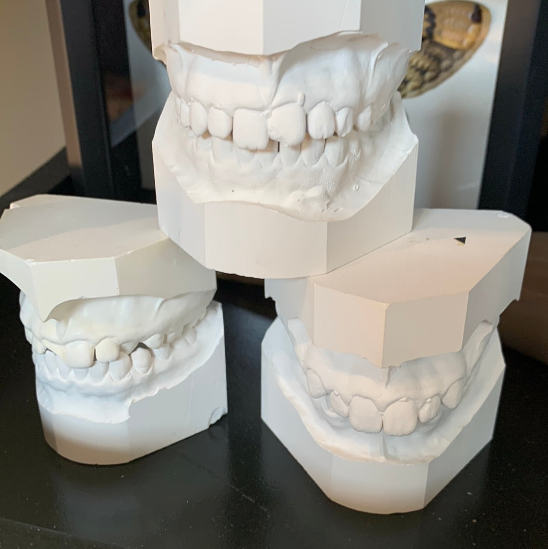Dandelion - Dental molds